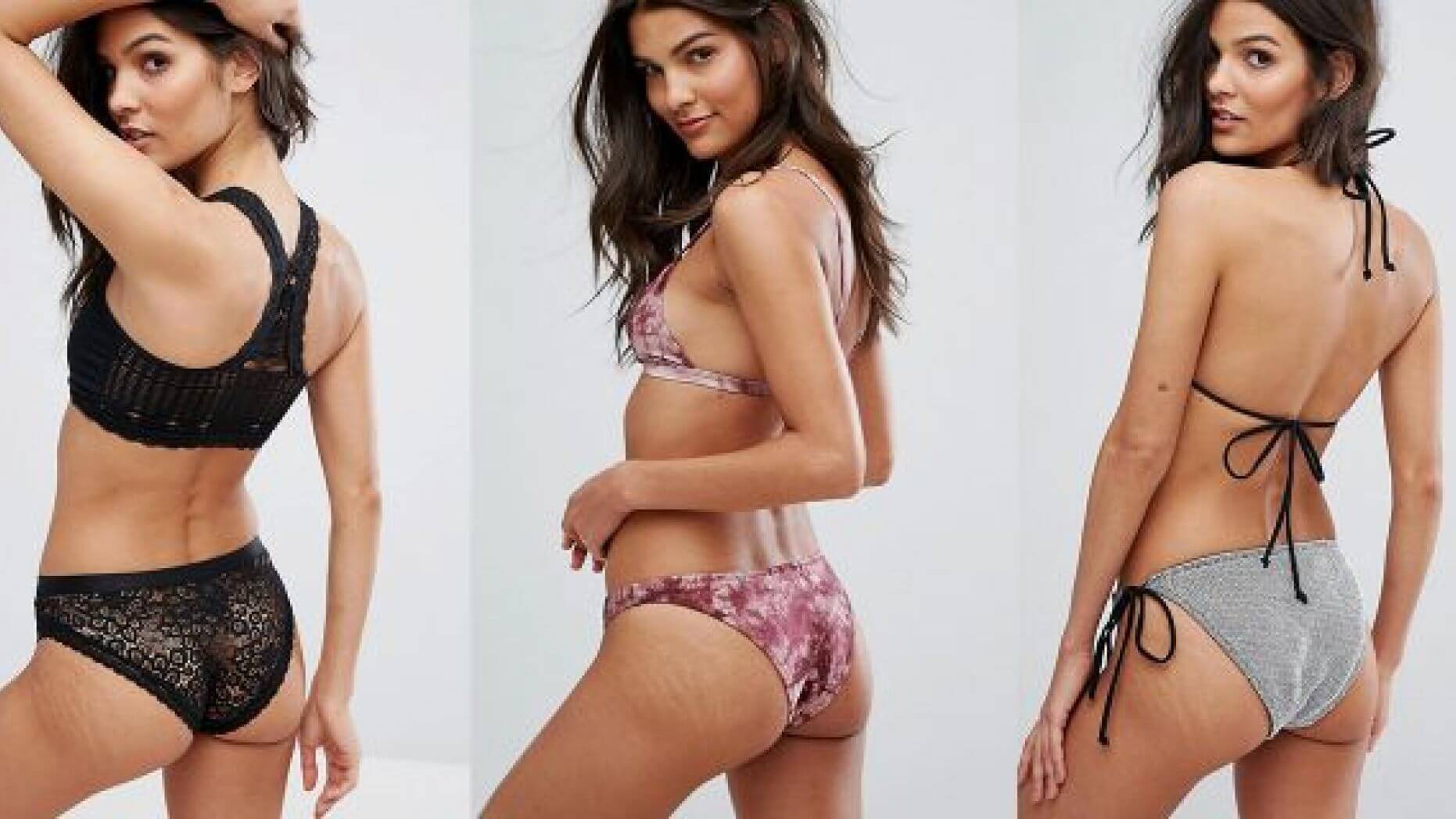 How to Handle Stretch Marks as a Female Model